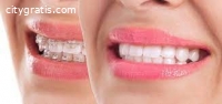 Teeth Whitening Auckland