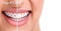 Teeth Whitening Auckland