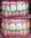 Century Smile