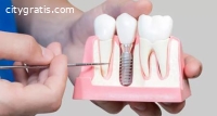 Dental Implants, Invisalign, Crowns, Den