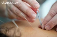 Dry needling in Denver
