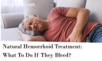 How To Treat Hemorrhoids At Home?
