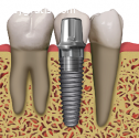 Southtowns Dental