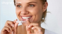 Teeth Porcelain Veneers Services in Hous