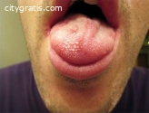 The Effects of Cutting Taste Buds